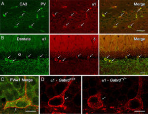 Molecule restores cognition, memory in Alzheimer’s disease – A4DP™