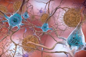 Alternative mechanisms behind Alzheimer’s disease – A4DP™