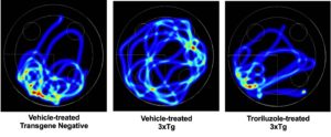 New drug shows promise in preventing early Alzheimer’s brain changes – A4DP™