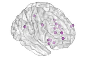 Brain network study reveals clues about dementia’s behavior changes – A4DP™