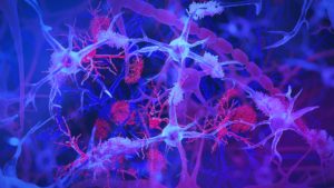 . . . more, gut infection could play a role in Alzheimer’s development – A4DP™