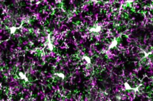 The brain’s immune system may curb damage in Alzheimer’s – A4DP™