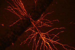 Synaptic changes during learning revealed by protein tracking