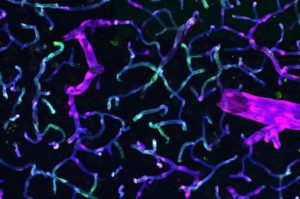 New toolkit for battling brain disorders
