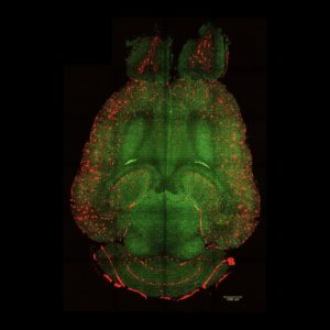 Alzheimer’s reversed in mice under breakthrough treatment