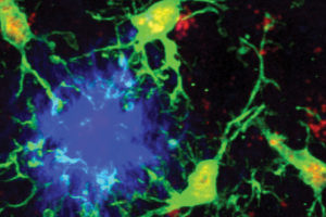 Protective microglia subtype offers potential therapeutic pathway in Alzheimer’s-  A4D™