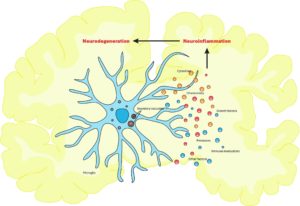 Role of brain inflammation in Alzheimer’s may depend on the behavior of microglia-  A4D™