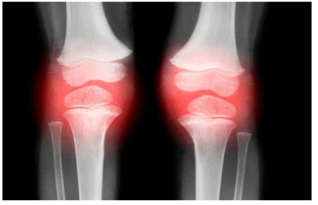 True Breakthrough Restores Osteoarthritic Aging Joints (w extensive images & videos)